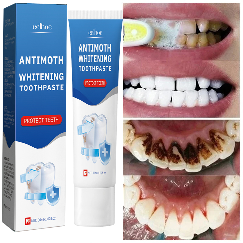 Fast Remove Smoke Stains Tooth - Teeth Whitening Fast review and price