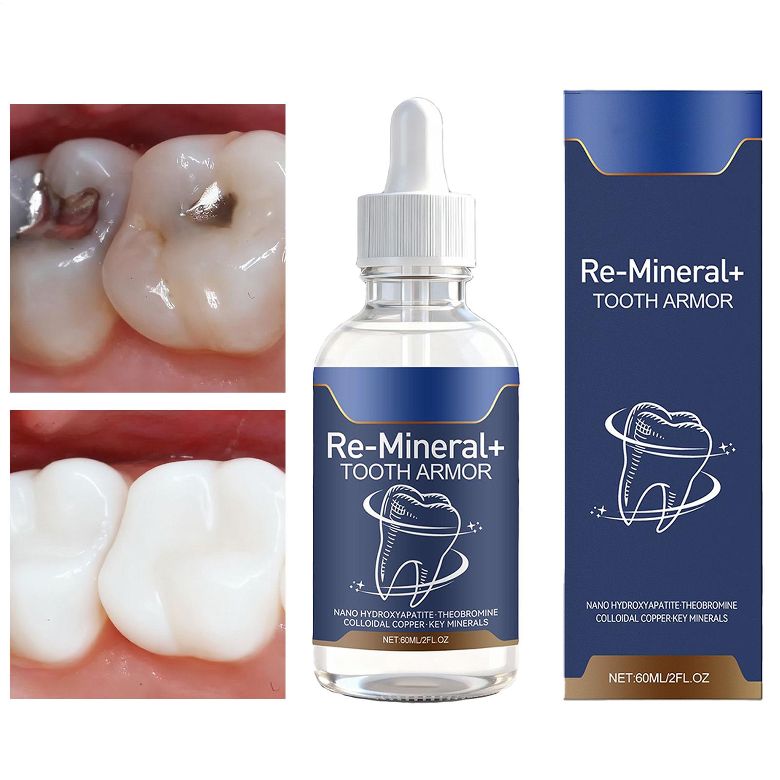 60ml Teeth Cleaning Liquid Rem - Teeth Whitening Products review and price