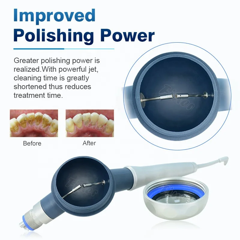 Prophy Mate Teeth Cleaning Whi - Teeth Whitening Fast review and price