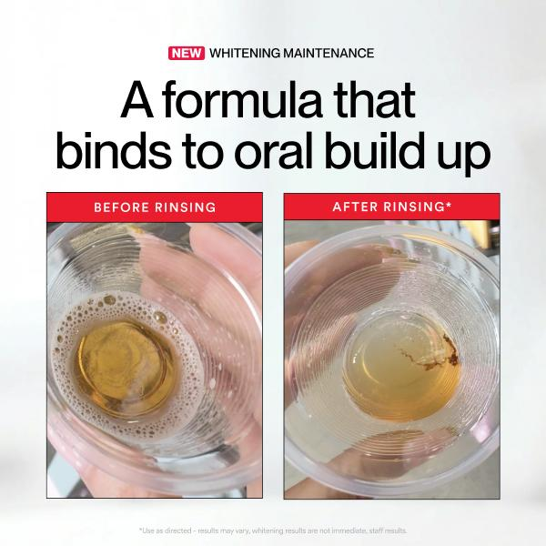 Hismile ID Whitening Stain Mou - Teeth Whitening Products review and price