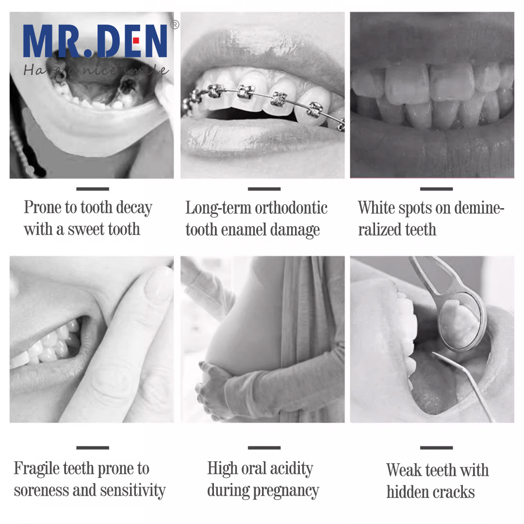 Japan GC Fluoride Enhanced Den - Teeth Whitening Japan review and price