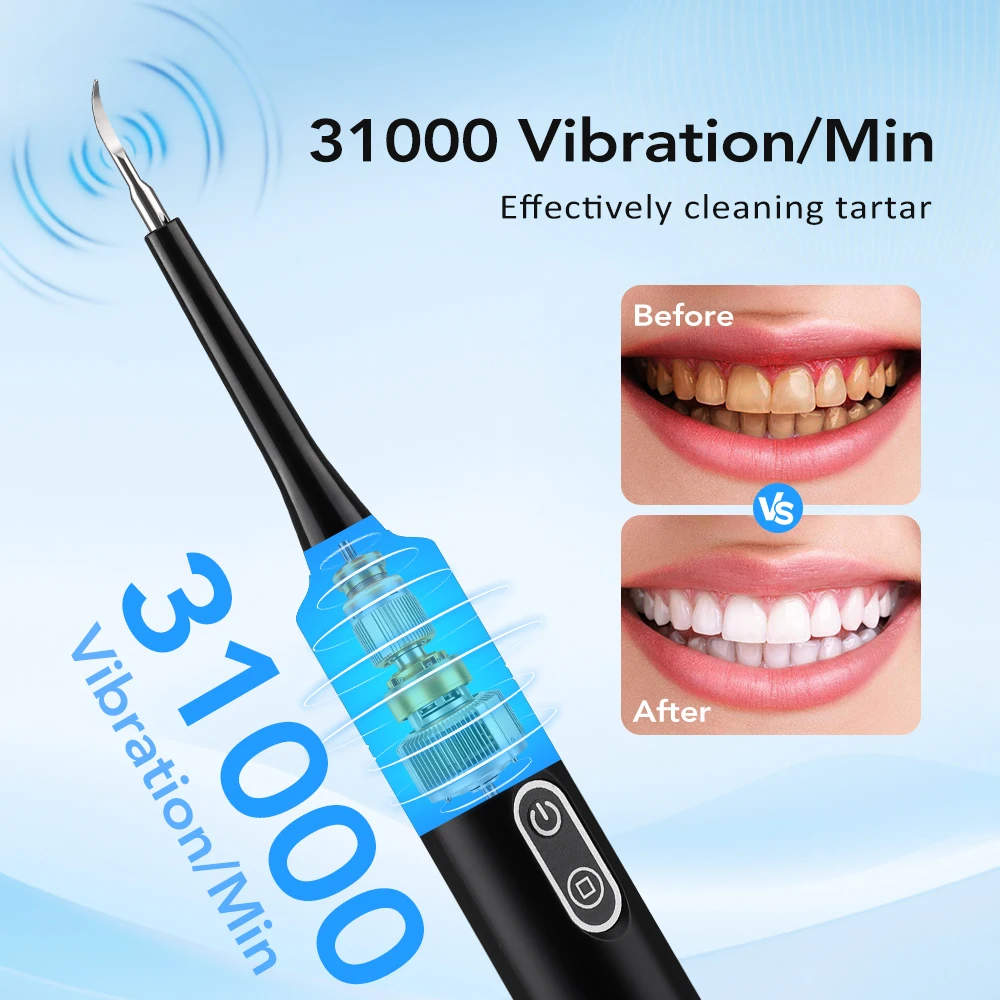 Electric Sonic Vibration Denta - Teeth Whitening Products review and price